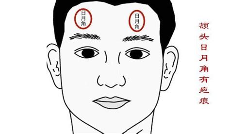 日月角隆起|面相解讀——額頭日月角